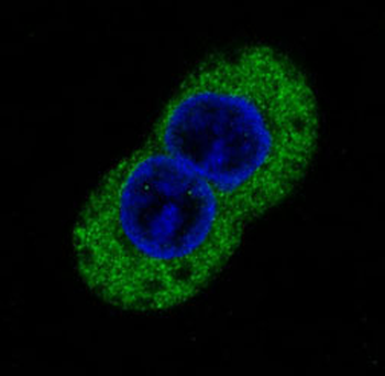 Phosphotyrosine Rabbit mAb Antibody