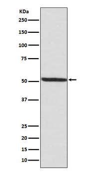 IRF3 (Phospho-Ser386) Rabbit mAb Antibody