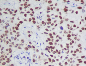 JAK2 (Phospho-Tyr1007/Tyr1008) Rabbit mAb