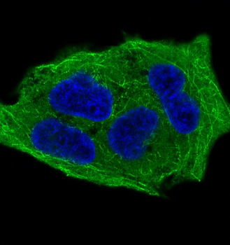 GSK3β(Phospho-Ser9) Rabbit mAb [KD Validated]