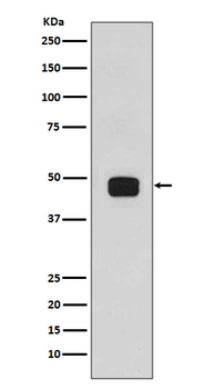 GSK3β(Phospho-Ser9) Rabbit mAb [KD Validated]