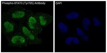 STAT3 (Phospho-Tyr705) Rabbit mAb [KD Validated]