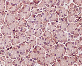 STAT3 (Phospho-Tyr705) Rabbit mAb [KD Validated]