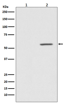 AKT1 (Phospho-Ser124) Rabbit mAb Antibody