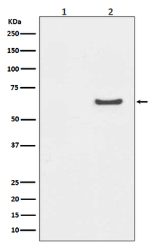 AKT1 (Phospho-Ser129) Rabbit mAb [KD Validated]