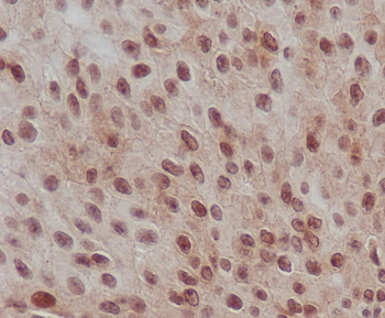 Smad2 (Phospho-Ser255) Rabbit mAb Antibody