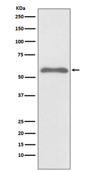 Smad2 (Phospho-Ser255) Rabbit mAb Antibody