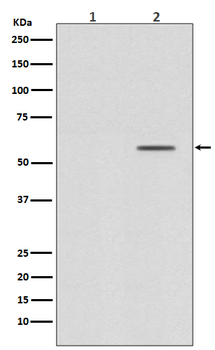 Smad2 (Phospho-Ser250) Rabbit mAb [KD Validated]