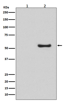 Smad5 (Phospho-Ser463/Ser465) Rabbit mAb Antibody