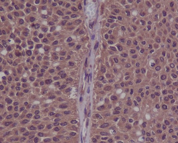 CDK2 (Phospho-Tyr15) Rabbit mAb Antibody