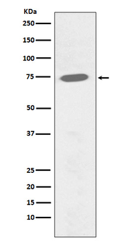BTK (Phospho-Tyr551) Rabbit mAb Antibody