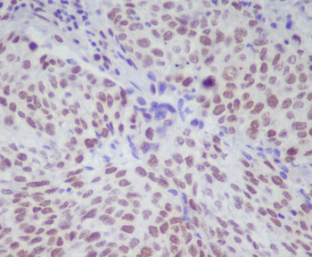 STAT1 (Phospho-Ser727) Rabbit mAb [KD Validated]