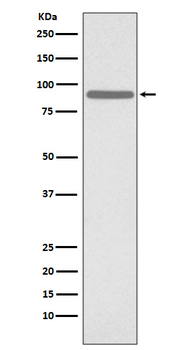 STAT1 (Phospho-Ser727) Rabbit mAb [KD Validated]