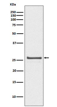 Hsp27 (Phospho-Ser82) Rabbit mAb Antibody