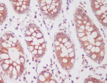 SIRT1 (Phospho-Ser47) Rabbit mAb