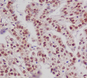 ER alpha (Phospho-Ser118) Rabbit mAb Antibody