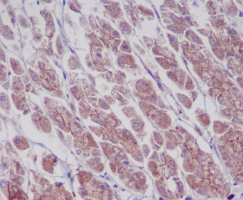 EGFR (Phospho-Tyr1173) Rabbit mAb [KD Validated]