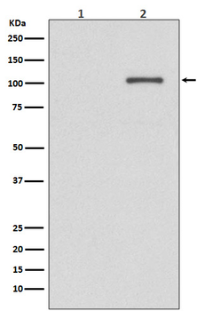 IRE1 (Phospho-Ser724) Rabbit mAb Antibody
