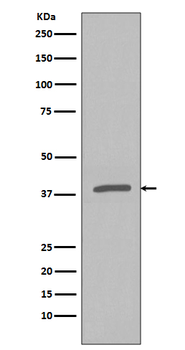 IKB alpha (Phospho-Ser32) Rabbit mAb Antibody