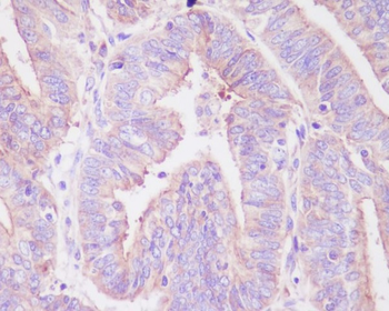 FoxO3a (Phospho-Ser253) Rabbit mAb Antibody