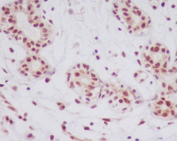JNK1/2/3 (Phospho-Thr183+Thr183+Thr221) Rabbit mAb