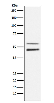 JNK1/2/3 (Phospho-Thr183+Thr183+Thr221) Rabbit mAb