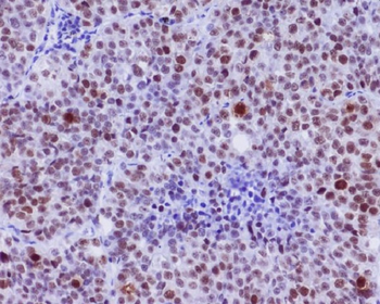 c-Myc (Phospho-Ser62) Rabbit mAb Antibody
