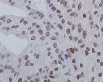 GATA3 (Phospho-Ser308) Rabbit mAb [KD Validated]