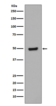 GATA3 (Phospho-Ser308) Rabbit mAb [KD Validated]