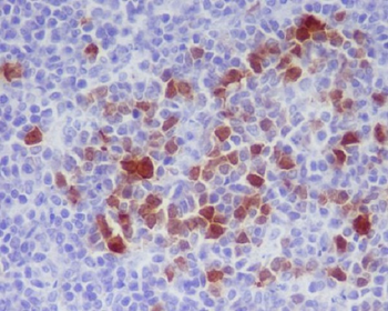 Cdk1/2 (Phospho-Thr14) Rabbit mAb Antibody