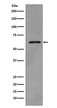 Src (Phospho-Tyr419) Rabbit mAb [KD Validated]