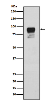 Glycogen synthase 1 (Phospho-Ser641) Rabbit mAb [KD Validated]