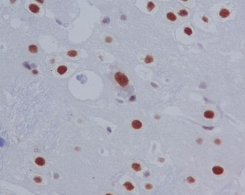 STAT3 (Phospho-Ser727) Rabbit mAb Antibody