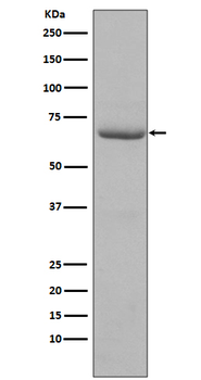 PKR (Phospho-Thr446) Rabbit mAb