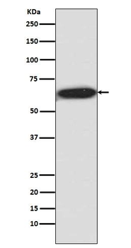 S6K1 (Phospho-Thr421/Ser424) Rabbit mAb