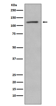 Retinoblastoma (Phospho-Ser780) Rabbit mAb Antibody