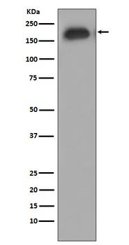 EGFR (Phospho-Tyr1068) Rabbit mAb