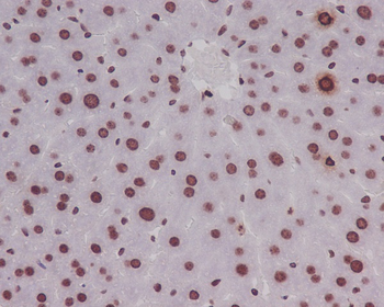 Histone H3 (Phospho-Ser10) Rabbit mAb