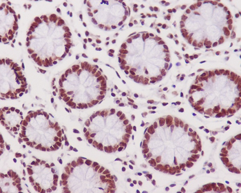 DNA PKcs (Phospho-Ser2056) Rabbit mAb [KD Validated]