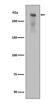 DNA PKcs (Phospho-Ser2056) Rabbit mAb [KD Validated]