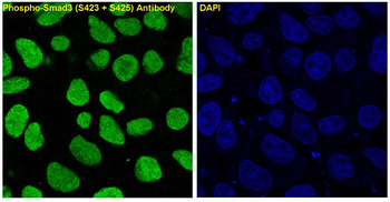 Smad3 (Phospho-Ser423/Ser425) Rabbit mAb