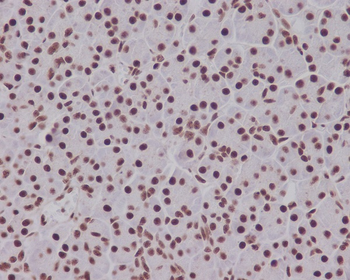 Smad5 (Phospho-Ser463/Ser465) Rabbit mAb Antibody