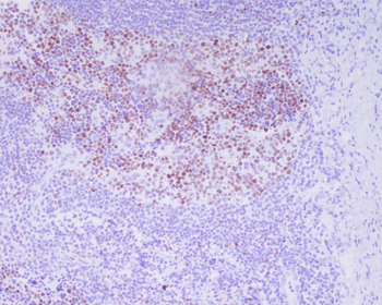 Histone H3 (Phospho-Thr3) Rabbit mAb