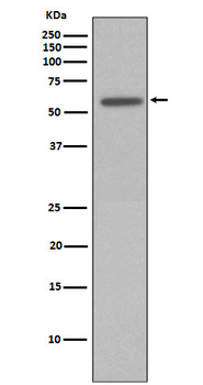Vimentin (Phospho-Ser72) Rabbit mAb Antibody
