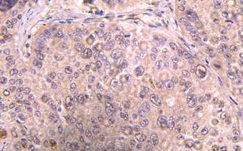 Recombinant IL6 Rabbit mAb(G12)