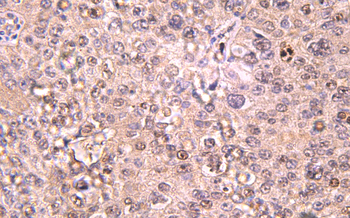 Recombinant IL6 Rabbit mAb(G12)