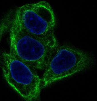 Cytokeratin 20 Antibody