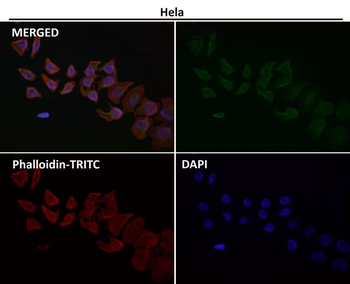Cytokeratin 20 Antibody
