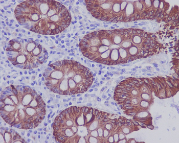 Cytokeratin 20 Antibody