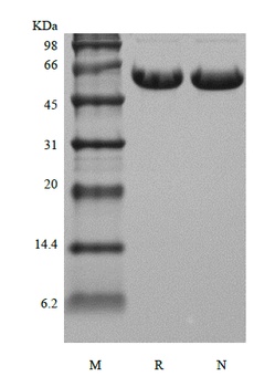 Recombinant Human Osteopontin/OPN